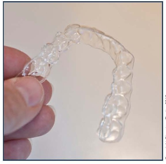 Invisalign® and Other Clear Shells
